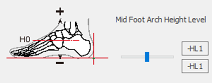 3. Foot Arch Height Level