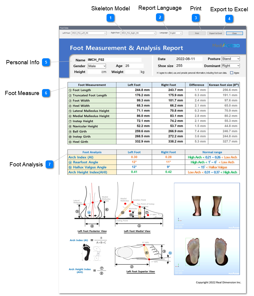 Foot Data