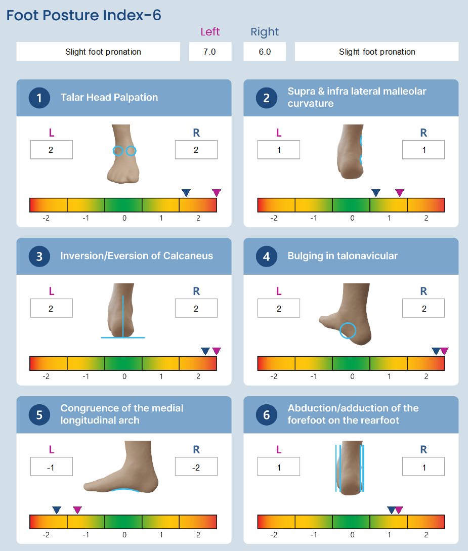 4. Foot Analysis