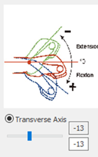 3. Transverse Axis