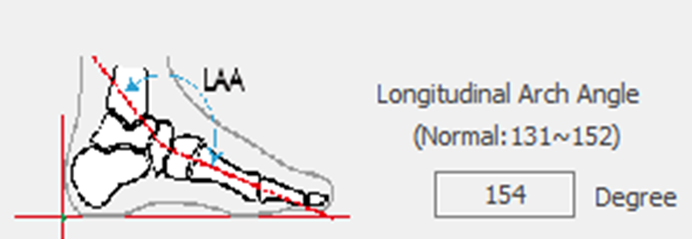 4. LAA Calculation