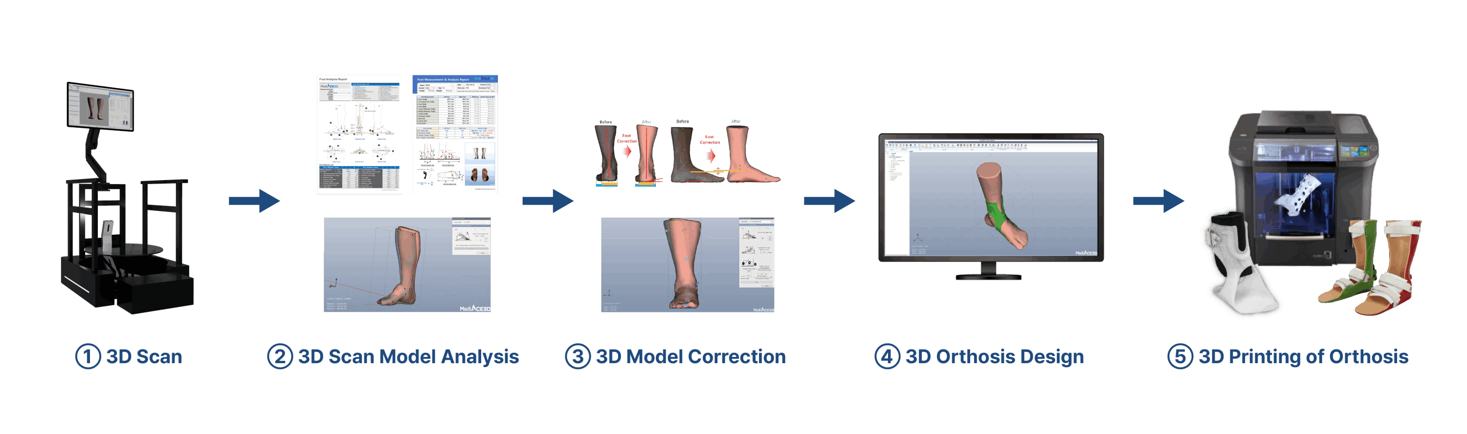 Additive Manufacturing System for Bespoke Orthosis